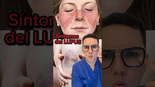 Síntomas de alerta de lupus que no debes ignorar  Dr William Guerrero medicina shorts ￼ [upl. by Pirozzo]