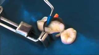 Ivoclar Vivadent AccessoryOptraMatrix OptraSculpt OptraContack [upl. by Illa]