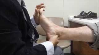 Examination of Flexor Hallucis Longus Tenosynovitis posterior Ankle Impingement examination [upl. by Jorge]