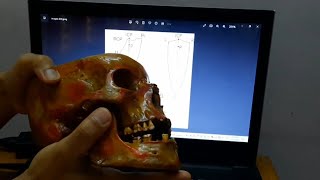 Posselts envelope of motion mandibular movements practical عربي [upl. by Oiramrej]