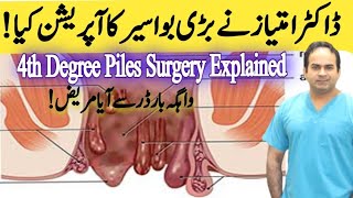 Operation of 4th Degree Piles  Haemorrhoidectomy of very big Piles  Surgeon Dr Imtiaz Hussain [upl. by Atsirak]