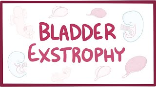 Bladder exstrophy  causes symptoms diagnosis treatment pathology [upl. by Killen]