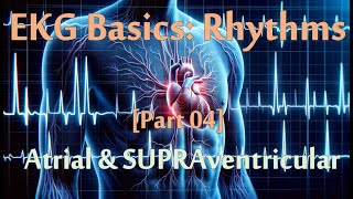 EKG Series 04 of 07 Rhythms  Atrial amp SVT rhythms 20 minutes of practice questions [upl. by Fleece535]