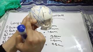 Diameter of fetal skull [upl. by Asert296]