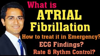 ATRIAL FIBRILLATION AFIB TREATMENT ECG INTERPRETATION PATHOPHYSIOLOGY AFIB MANAGEMENT LECTURE [upl. by Ilanos]