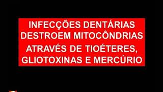 Dr Lair Ribeiro Tratamento de Canal dentário como foco de doenças crônicas [upl. by Artek745]