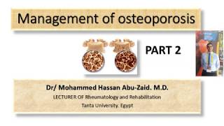 management of osteoporosis part 2 [upl. by Essam]