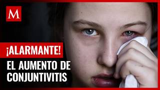 Casos de conjuntivitis en Tamaulipas lo colocan en el tercer lugar nacional [upl. by Atiuqehs315]