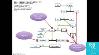 Intracerebral Hemorrhage Part 4  Health4TheWorld Academy [upl. by Aitnom]