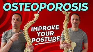 Osteoporosis How to Fix Your Back HumpKyphosis [upl. by Eidas]