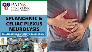 Splanchnic amp Celiac plexus Neurolysis Procedure [upl. by Naenej]