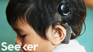 How Do Cochlear Implants Work [upl. by Porter19]