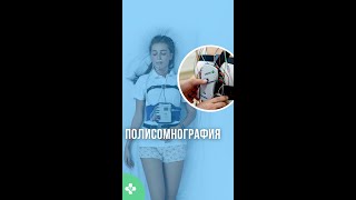 💤 Диагностика сна и лечение храпа 😴 полисомнография лечениехрапа лечениебессонницы здоровыйсон [upl. by Otilegna746]