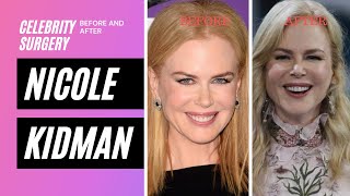 Nicole Kidman  Celebrity Plastic Surgery Review by Rachel Varga [upl. by Ardnossak]