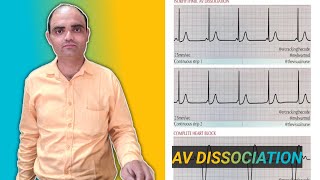 AV DISASSOCIATION IN HEART DISEASE BY DRSUMIT TYAGISUMITMEDICALDISPENSARY1 [upl. by Safir306]