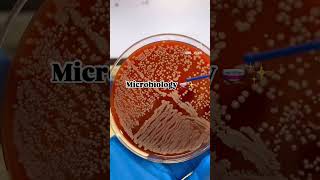 Microbiology is just mbbs dentalschoollife dentalschooladmission medicalstudent youtubeshorts [upl. by Cornall]