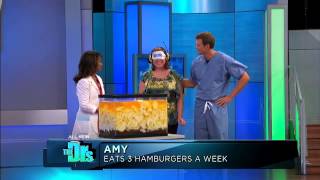 Fast Food Blindfold Challenge Medical Course [upl. by Leila]