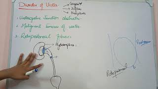 male genital system pathology lecture 9 URETER DISORDERS [upl. by Colbert]