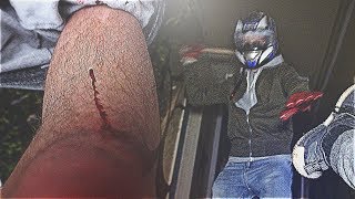 MASKED MAN WITH A BAT TRIED TO KILL ME Whilst Exploring Abandoned MENTAL ASYLUM NOT CLICKBAIT [upl. by Marx]