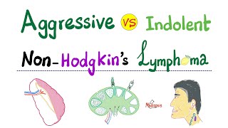 NonHodgkins Lymphoma  Aggressive type VS Indolent type  Hematology and Oncology [upl. by Hildebrandt]