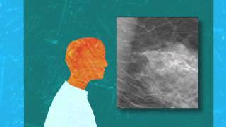 What is 3D Mammography [upl. by Thurnau]