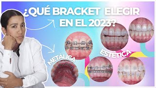 🦷VENTAJAS Y DESVENTAJAS DE ESTOS TIPOS DE ORTODONCIAS I 🦷 2023 DRA MINERVA FELIPE dentalcare [upl. by Dimitry]