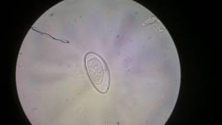 Egg of Enterobius vermicularis [upl. by Dnalhsa]