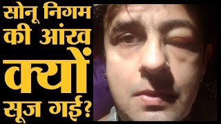 Sonu Nigam की ये दो फोटोज़ देखकर आपको क्यों डरना चाहिए  The Lallantop [upl. by Kyriako]