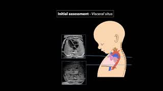 Fetal Echocardiography Protocol and Technique [upl. by Tsnre]