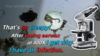 After seeing earwax at 400X I get why I have an infection [upl. by Ahsuatan]