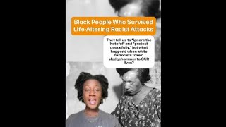 Black People Who Survived LifeAltering Racist Attacks [upl. by Plato914]