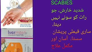 scabies khujli ka ilaj skin elarji ka ilaj harish ka ilaj shahhussain6718 oladoc [upl. by Eceertal]