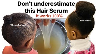 Use This Hair Serum if you’ve tried everything Boost hair growth length retention Hair Volume [upl. by Melamed]