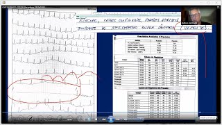 Diagnóstico e Tratamento da Disautonomia  Síndrome Postural Ortostática Taquicardizante [upl. by Ahtiekal]