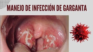 Manejo de la Infección y dolor de garganta [upl. by Dirgis]