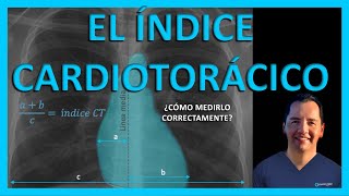 🥇 Indice CARDIOTORACICO  Cómo se CALCULA el índice CARDIOTORÁCICO 🤔 Radiología para ESTUDIANTES [upl. by Kline23]