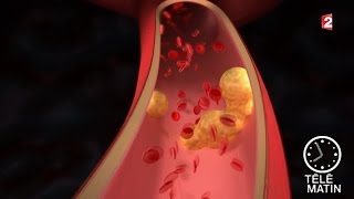 Santé  Statines et cholestérol  20151111 [upl. by Mathews]