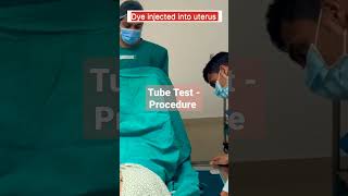 HSG Test  How its done infertility hsgtest viralshorts shorts tubetest [upl. by Sorgalim]