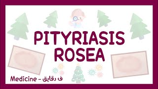 Pityriasis rosea  definition clinical picture diagnosis amp treatment شرح عربي [upl. by Herriott]