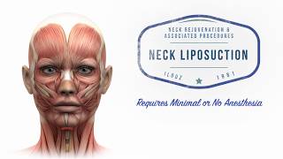 Neck Lift 101 Plastic Surgery Techniques for the Neck  Aesthetic Minutes NeckLift [upl. by Halyak]