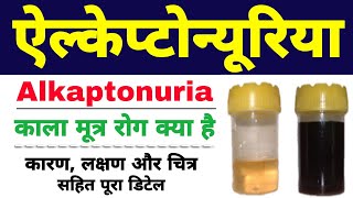 Alkaptonuria in hindi class 12 biology  black urine disease  ऐल्केप्टोन्यूरिया Biology ScienceSK [upl. by Lenor403]