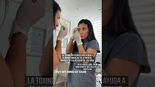 Aplicación de Toxina Botulínica Para qué sirve [upl. by Enyamrahs418]