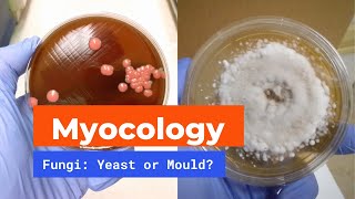 Microbiology Mycology  Yeast and Mould [upl. by Oisorbma]