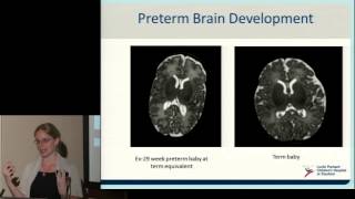 Neurodevelopment of Preterm Babies [upl. by Meehan]