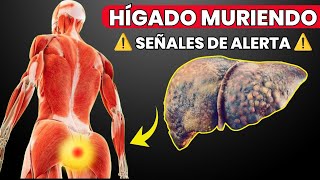 13 Signos Extraños de DAÑO en el HÍGADO [upl. by Petty188]