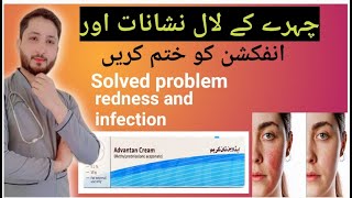 How to solved problem face redness skin Infection problem solved advantan cream [upl. by Enylecoj]