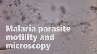 Jake Baum on the motility of malaria parasites [upl. by Dnalrag]