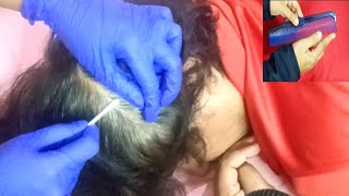 Tingly Scalp Scratching ASMR Massage [upl. by Eemla]