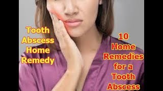 tooth abscess home remedy  10 Home Remedies for a Tooth Abscess [upl. by Ambrosio177]