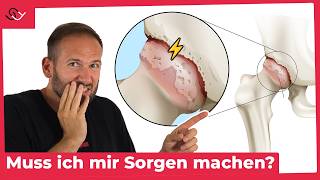 Ist dein Hüftgelenk gesund Mach den Test Dauert 5 Sek [upl. by Robet]